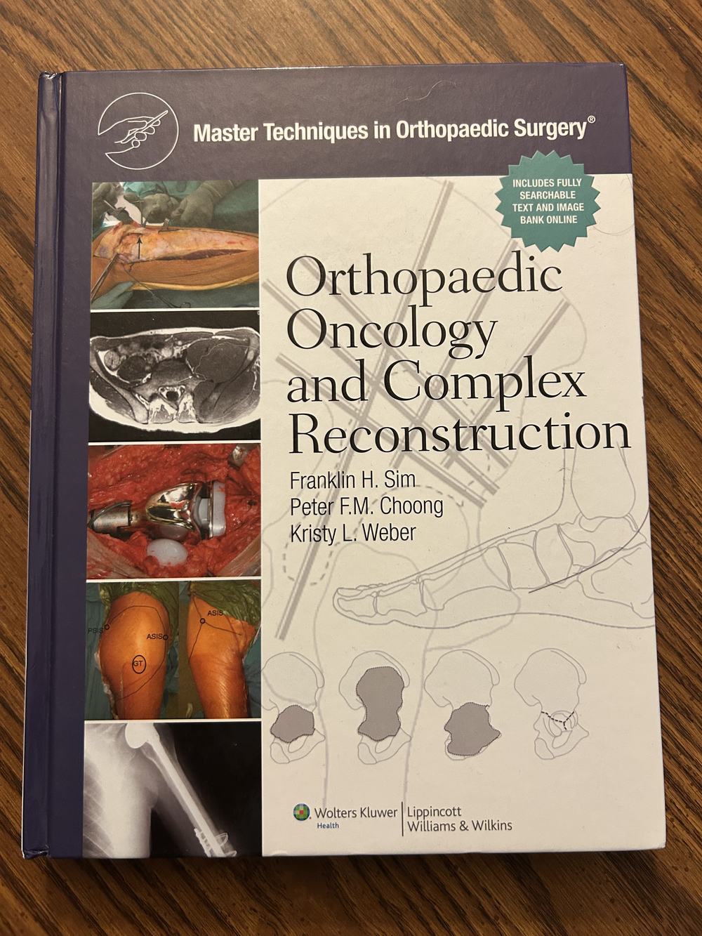 Master Techniques in Orthopaedic Surgery: Orthopaedic Oncology and Complex Reconstruction, photo 1 of 7